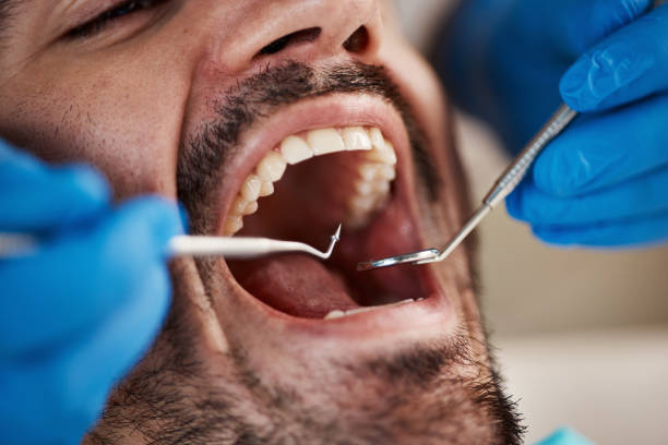 Best Emergency Treatment for Oral Infections in Selmer, TN